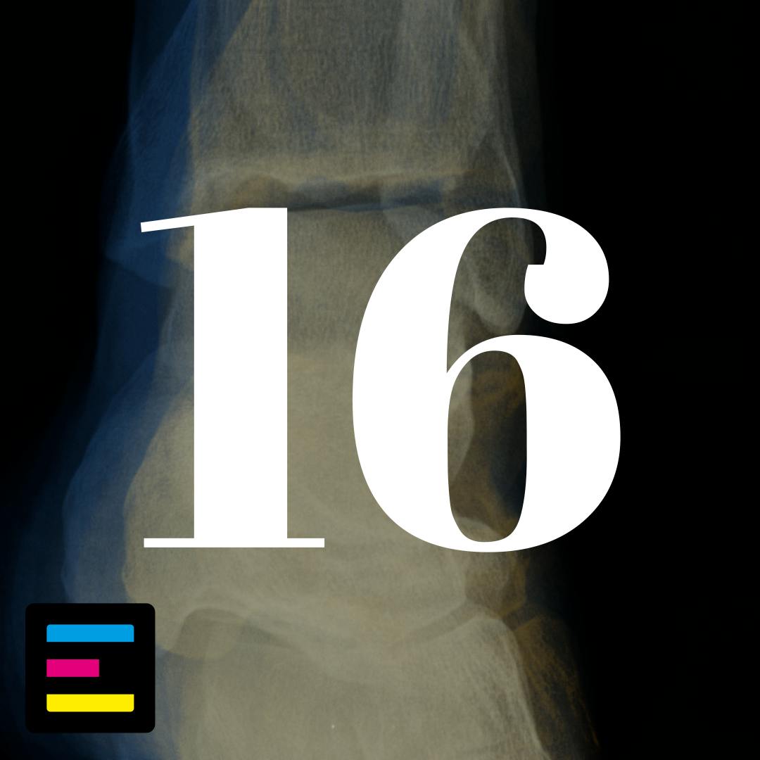 16