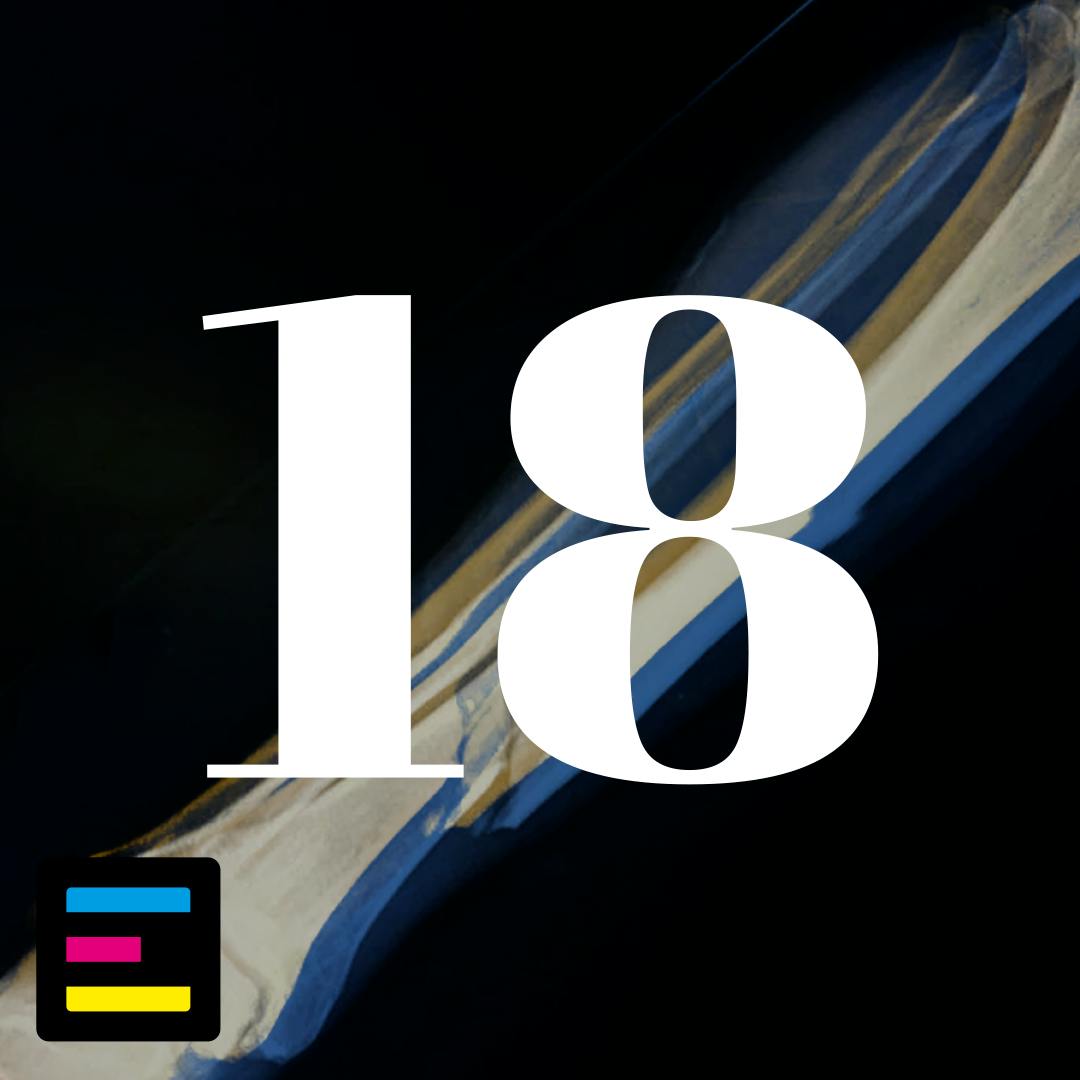 18