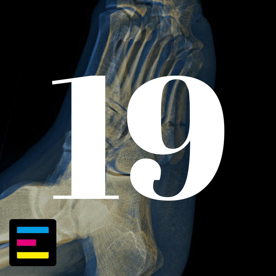19