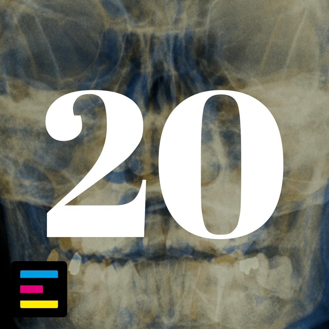 20