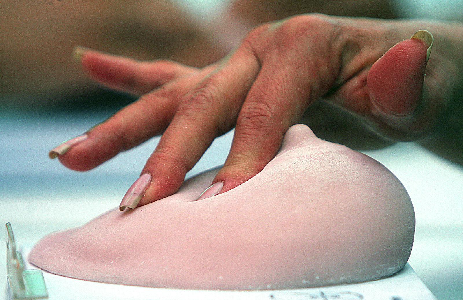 Octubre, mes del cáncer de mama: especialista dice que "es una verdadera pandemia"