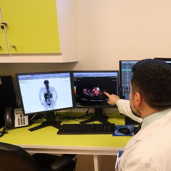 Dr. Melkonian por aumento de cáncer de colon: “Los factores de riesgo son el consumo en exceso de carnes rojas, alcohol y tabaco”