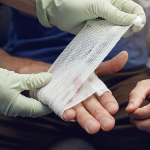 Académica U. de Chile por parche bioactivo: “Las ventajas que proporciona este material es que se pueda liberar rápidamente el agente antibacteriano”