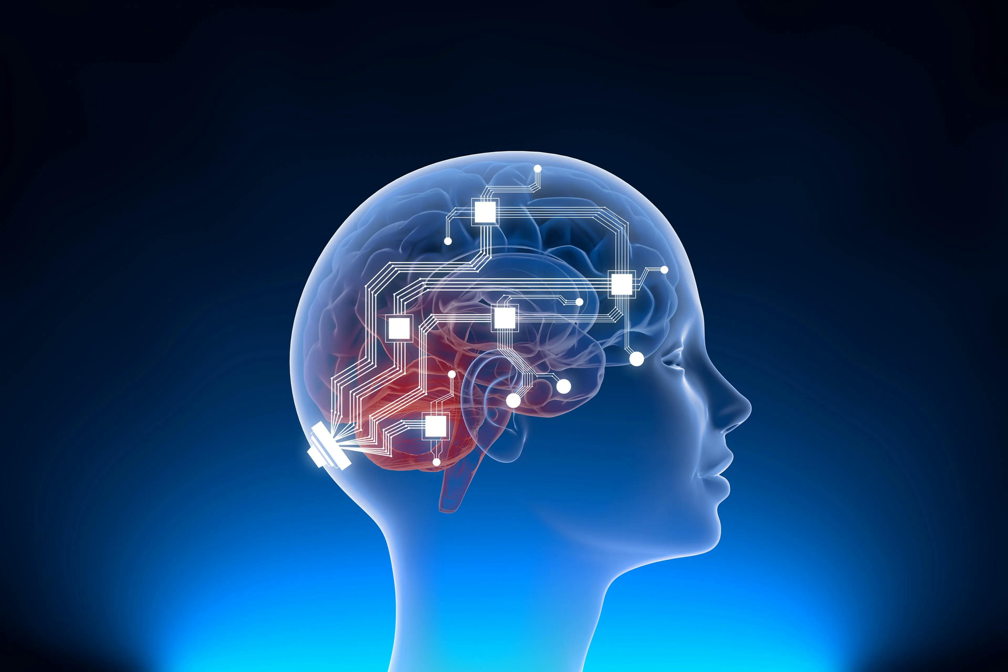 Chip cerebrales y su posible impacto 