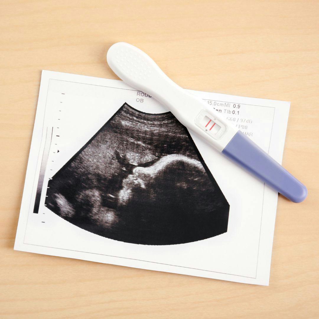 La situación de la fertilización asistida en Chile