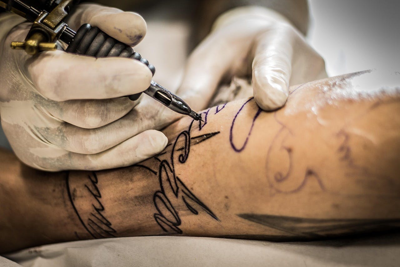 Entrenadora de tecnología láser de la clínica Marsella por tratamientos para borrar tatuajes: “La mayoría es porque ya no les gusta”