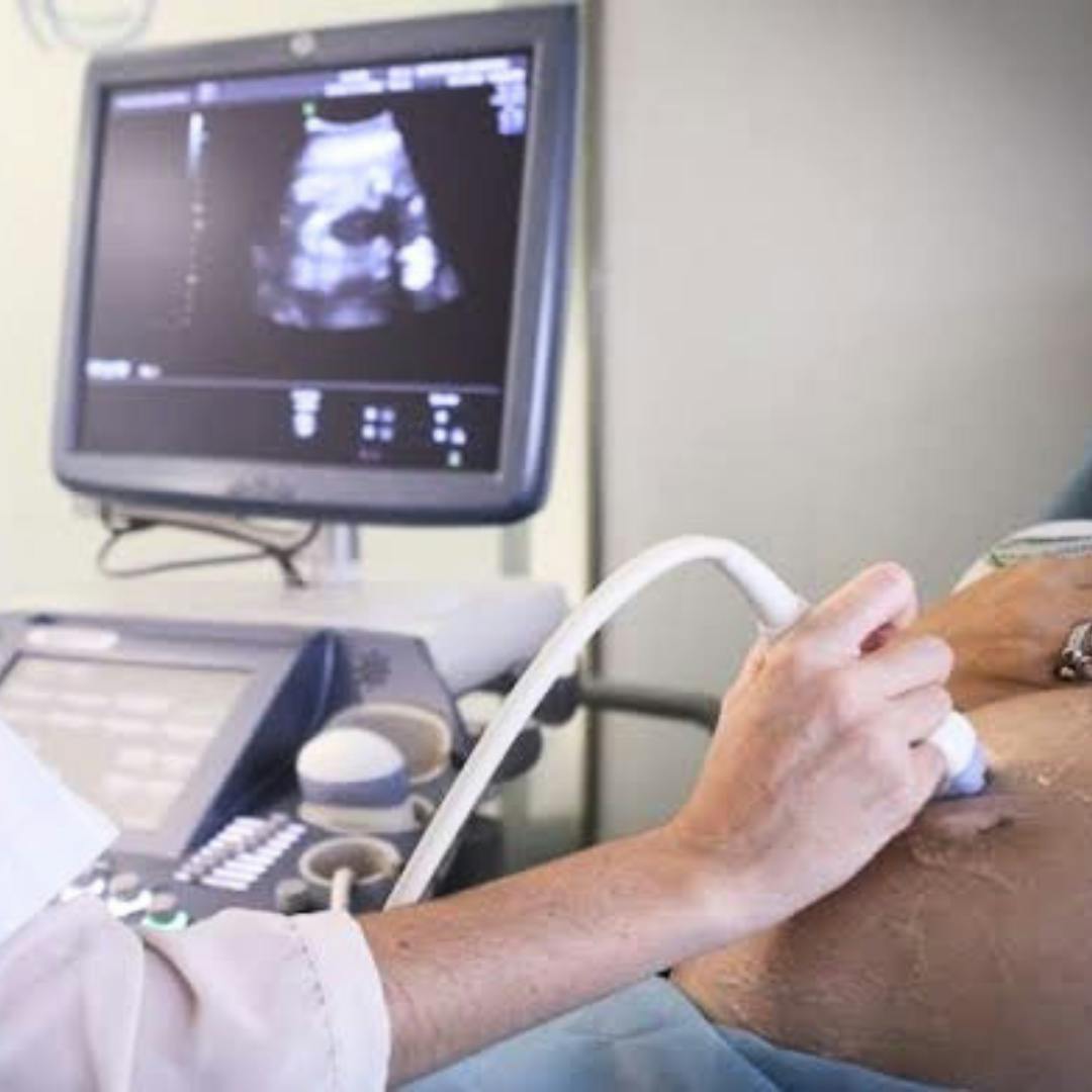 El problemático silencio de La Moneda por proyecto que condiciona el aborto a la escucha del latido fetal