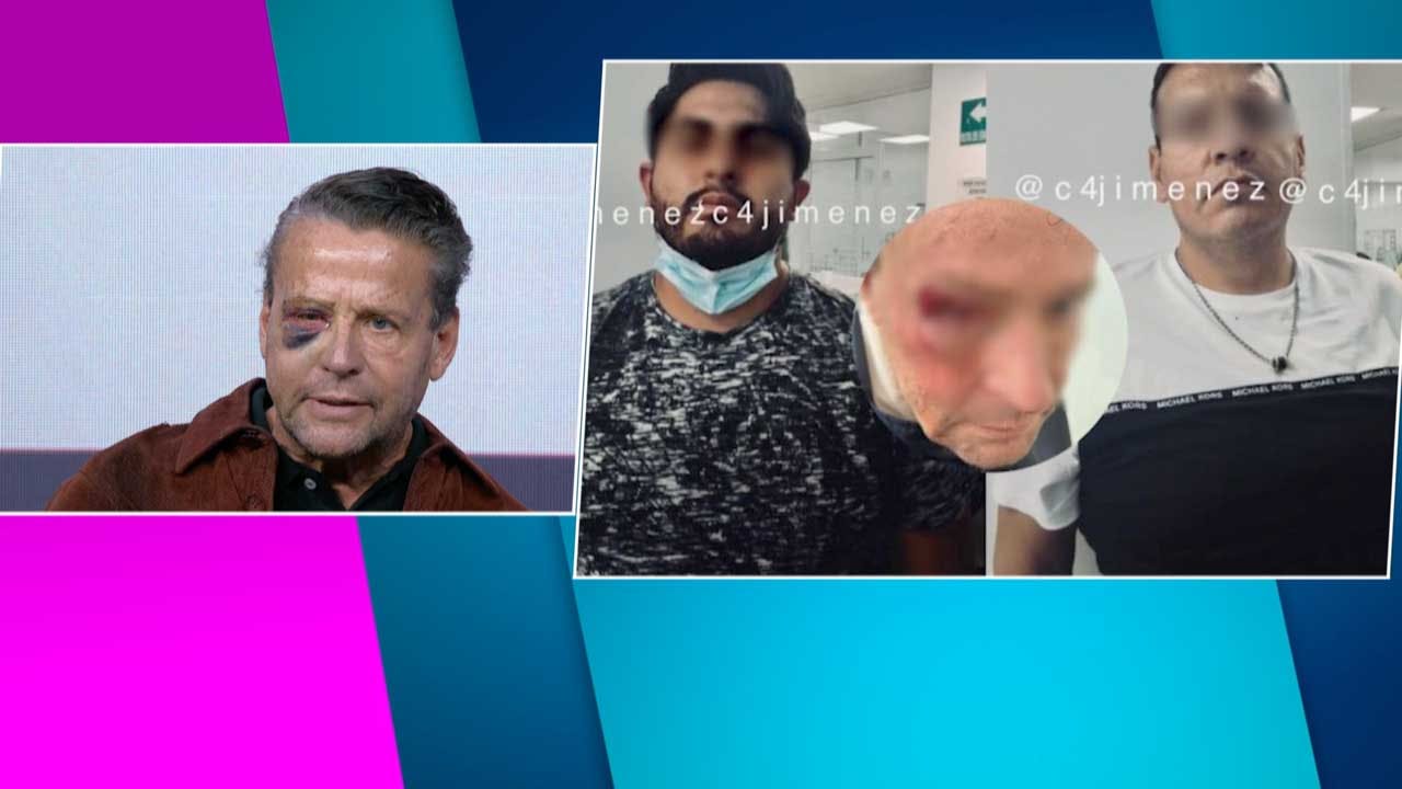 Alfredo Adame explica qué necesitará para que sane su ojo tras golpes.