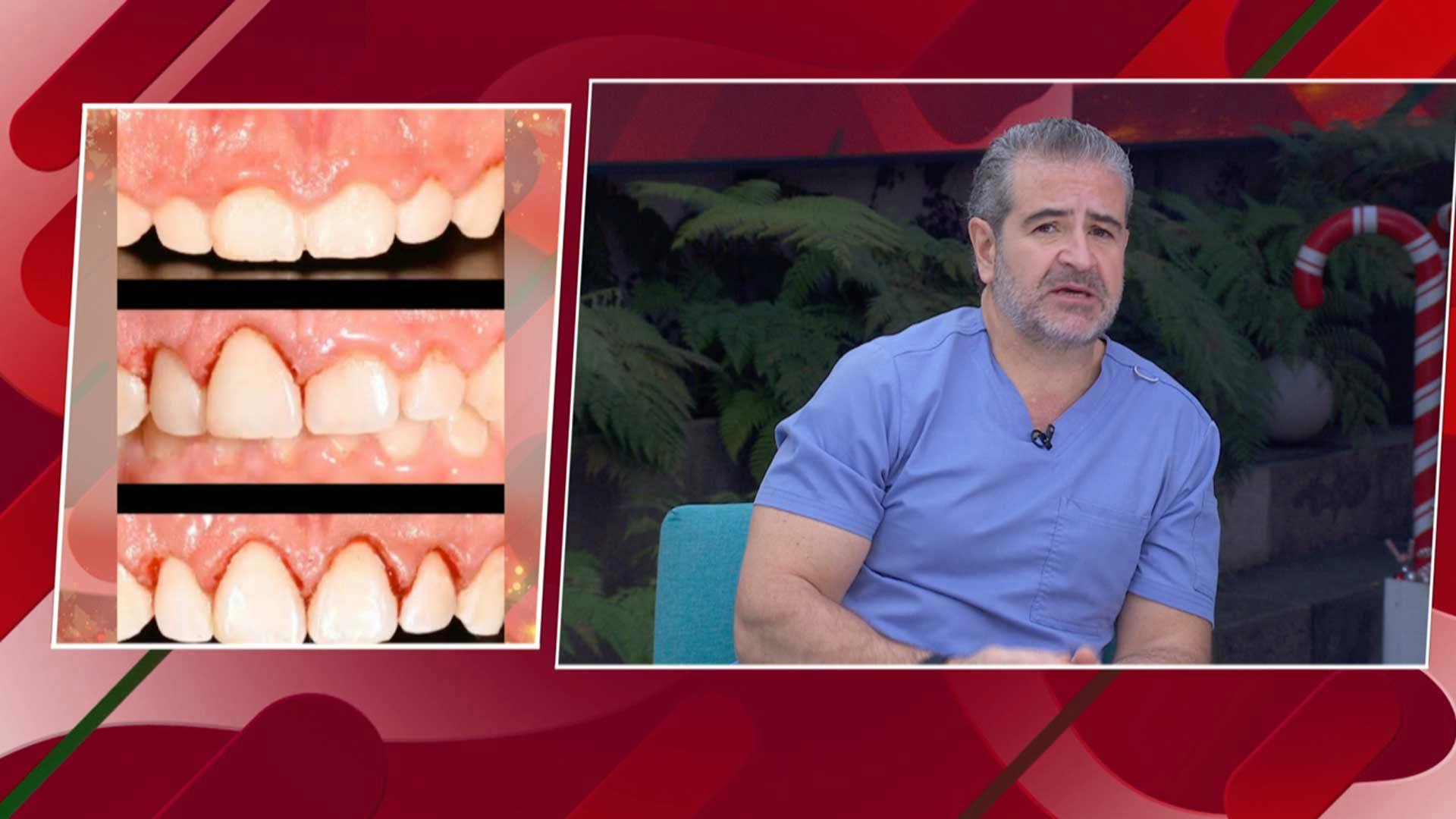 ¿Sabes lo que es la Sonrisa gingival? ¡Descubre cómo corregirla!