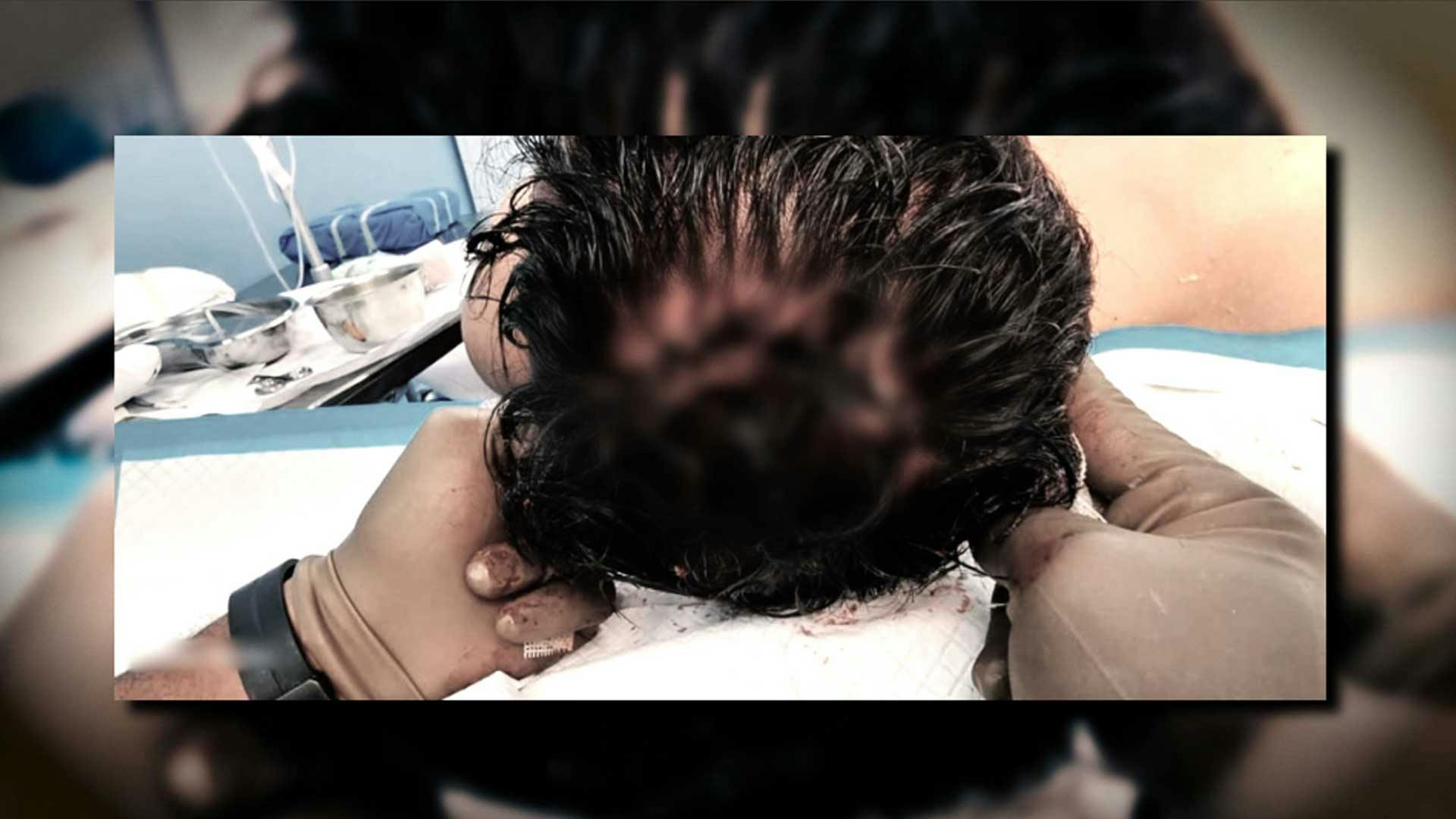 Heliud y Nano cuentan cómo vivieron el accidente de Pato Araujo en Exatlón