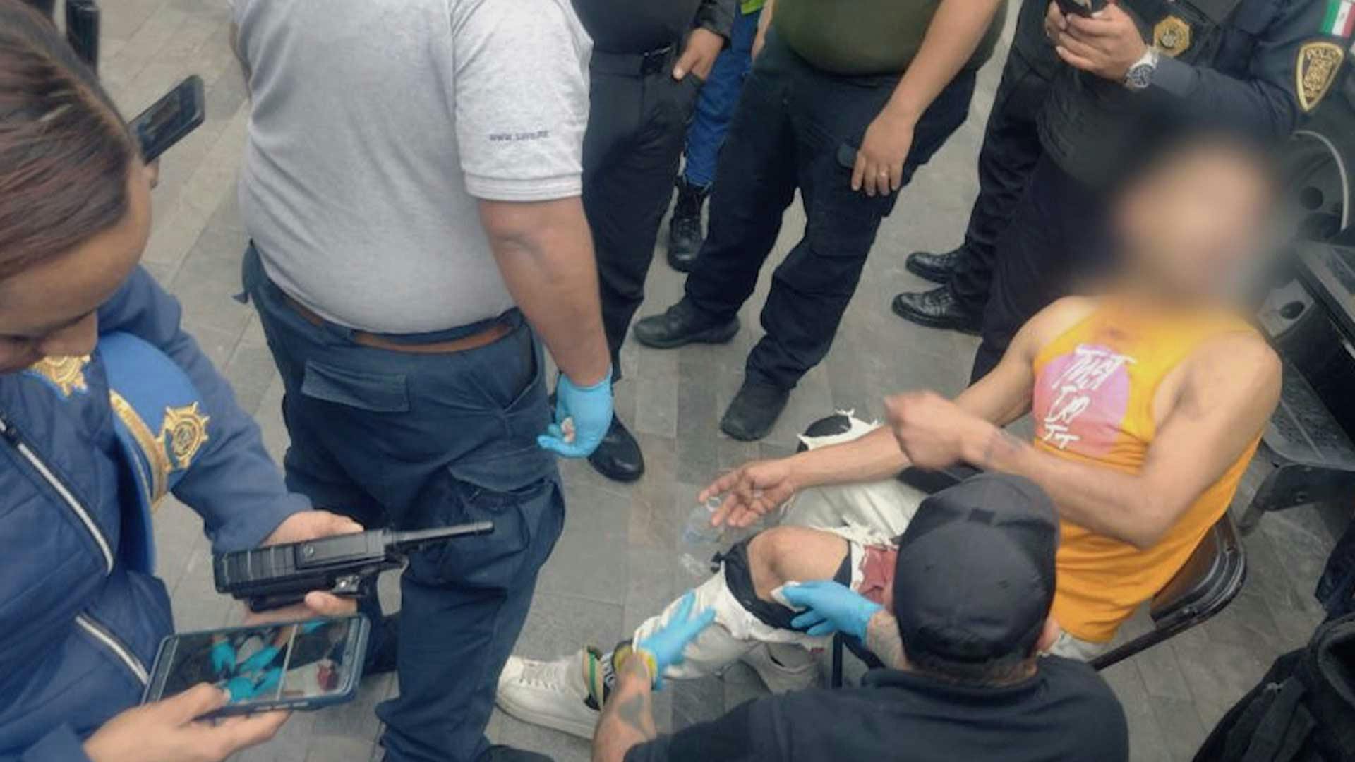 Tenía varias heridas en el cuerpo, ¡le dispararon con un arma de balines!