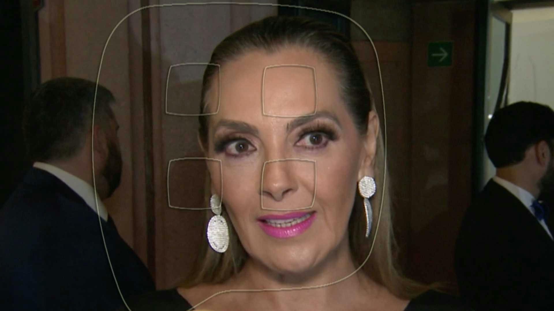Hermana de Kate del Castillo advierte el riesgo de usar implantes mamarios