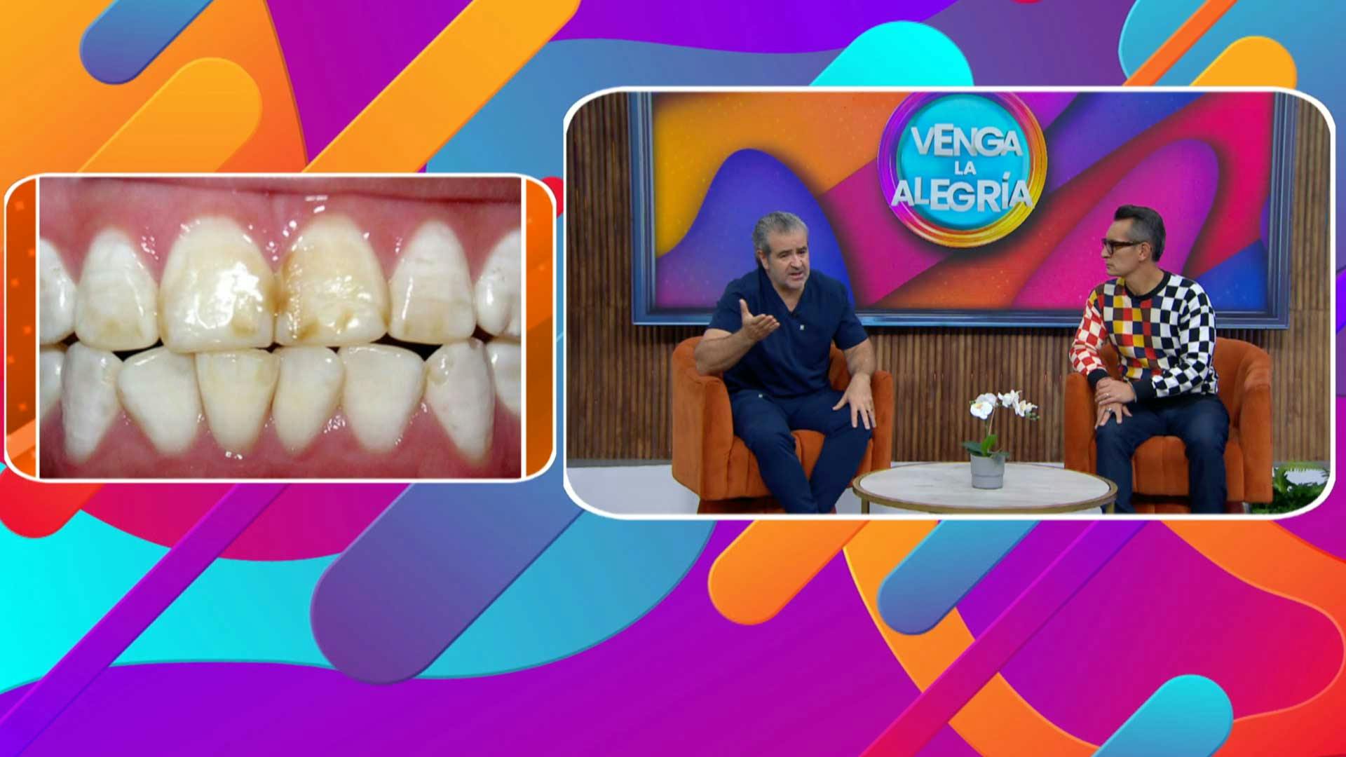 ¡Por cigarro, vino y hasta agua! ¿Por qué aparecen manchas en los dientes? El Dr. Hernández Guerreiro despejó las dudas y compartió valiosos tips