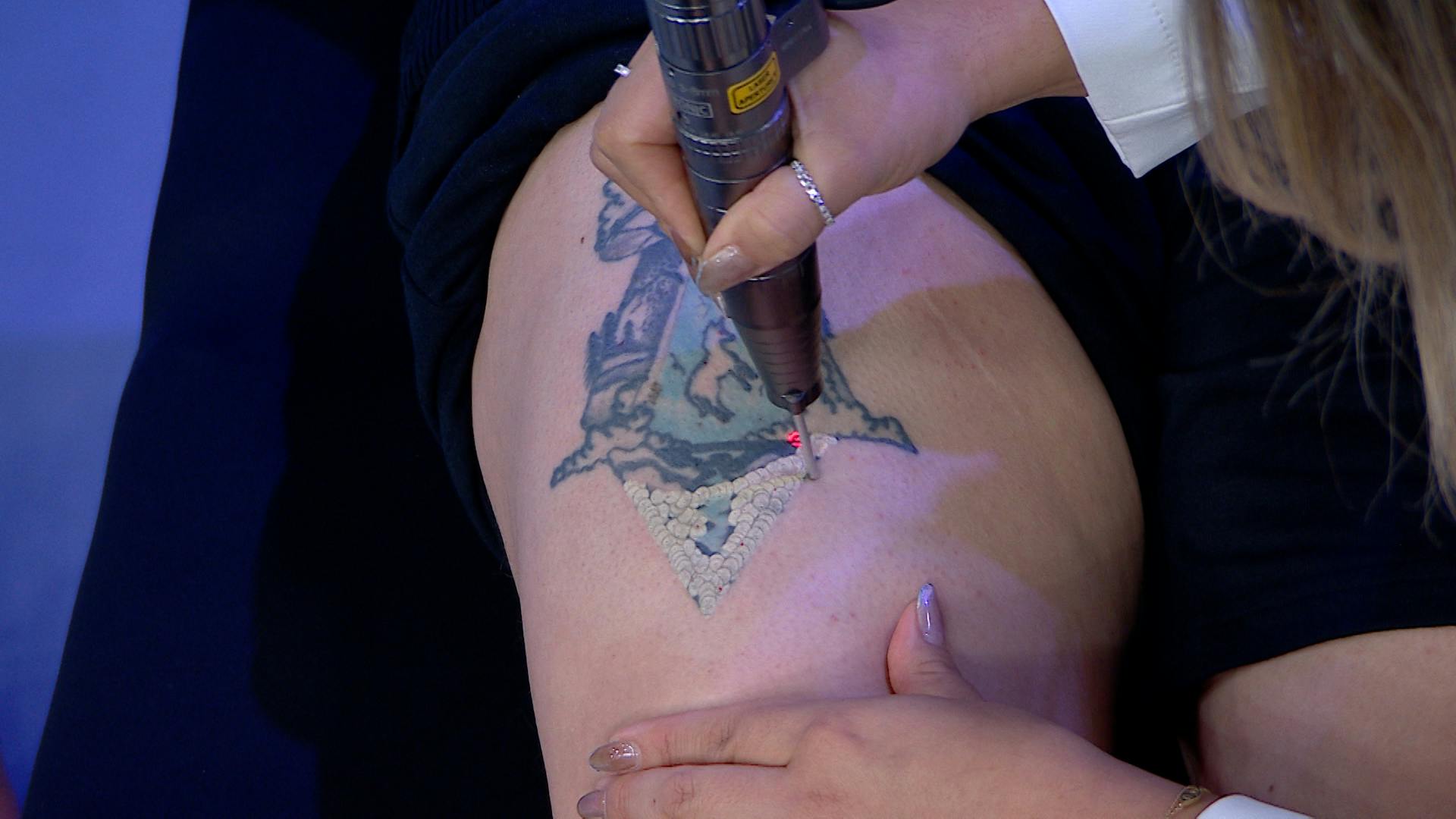 ¿Te arrepentiste o no era lo que esperabas? ¡Así puedes borrar ese tatuaje que ya no te gusta!