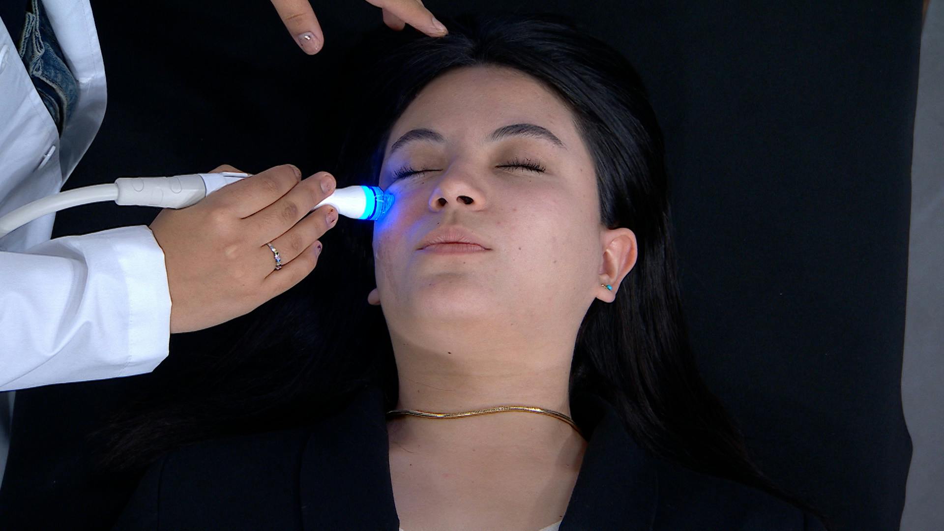 Cuida tu piel: Tratamiento facial no invasivo para hidratar y renovar tu piel