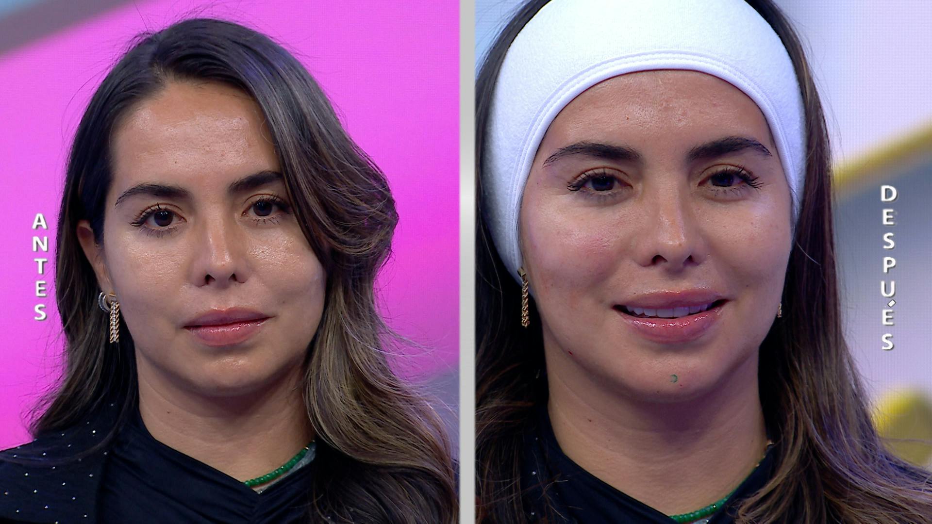 Conoce el tratamiento para rejuvenecer, fortalecer y reparar la piel del rostro