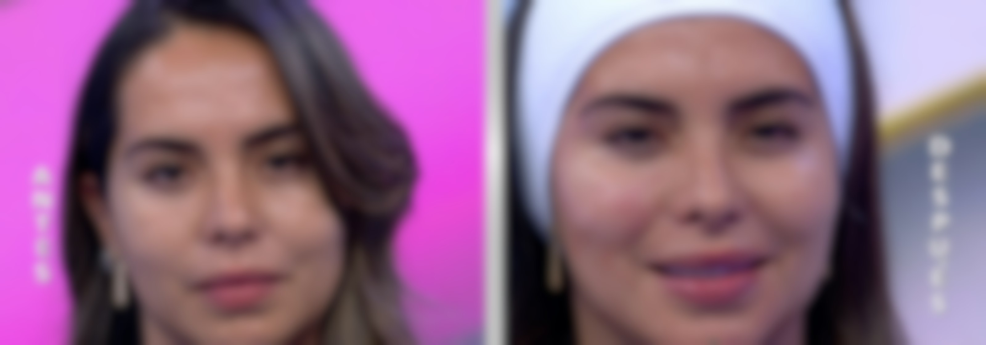 Conoce el tratamiento para rejuvenecer, fortalecer y reparar la piel del rostro