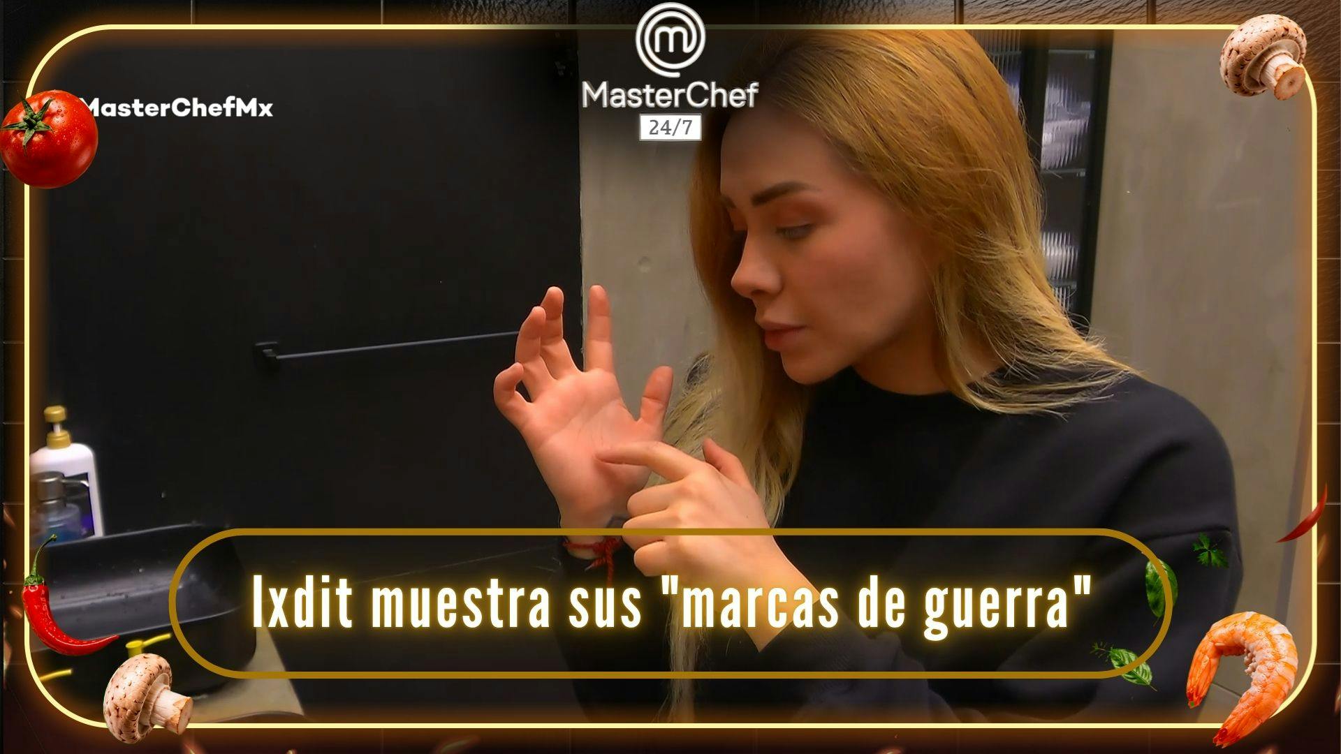 Ixdit muestra sus “marcas de guerra” previo a la gala de salvación de MasterChef 24/7 (VIDEO)