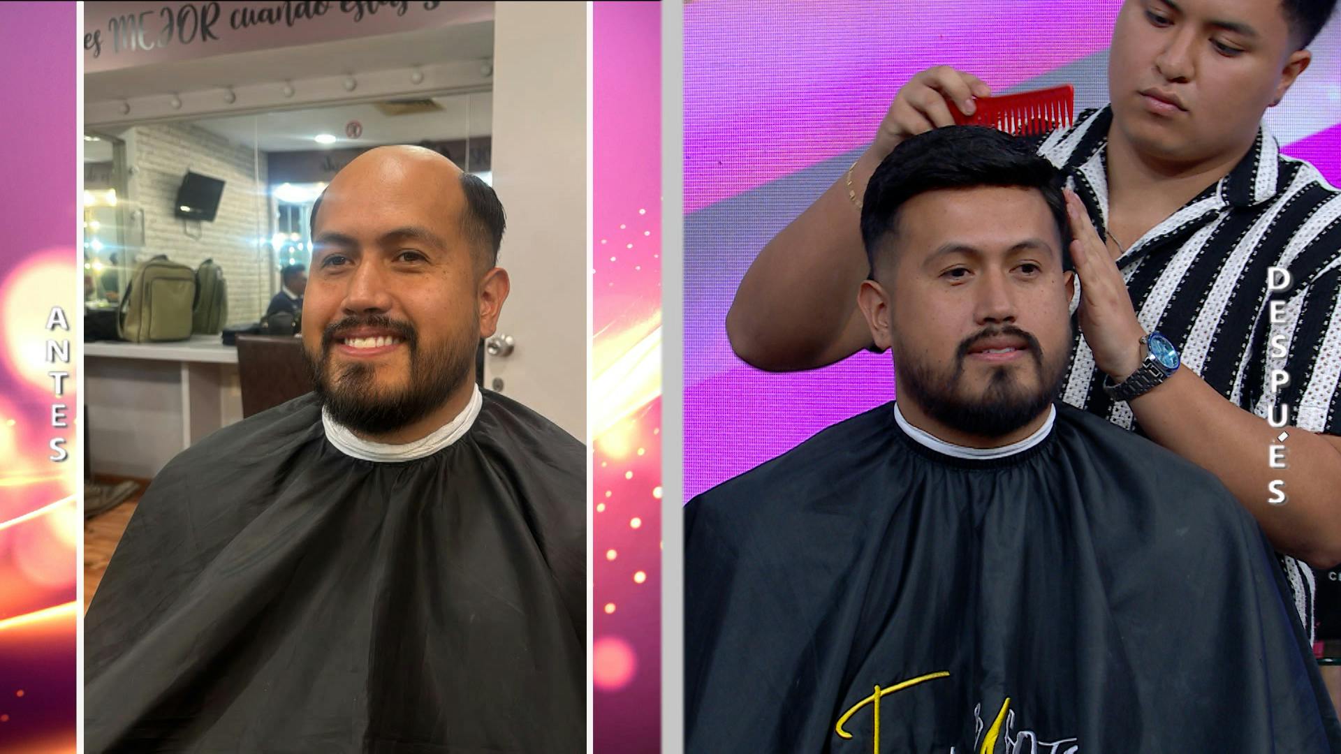 ¿Te estás quedando sin cabello? ¡Checa estas prótesis capilares prácticamente indetectables!