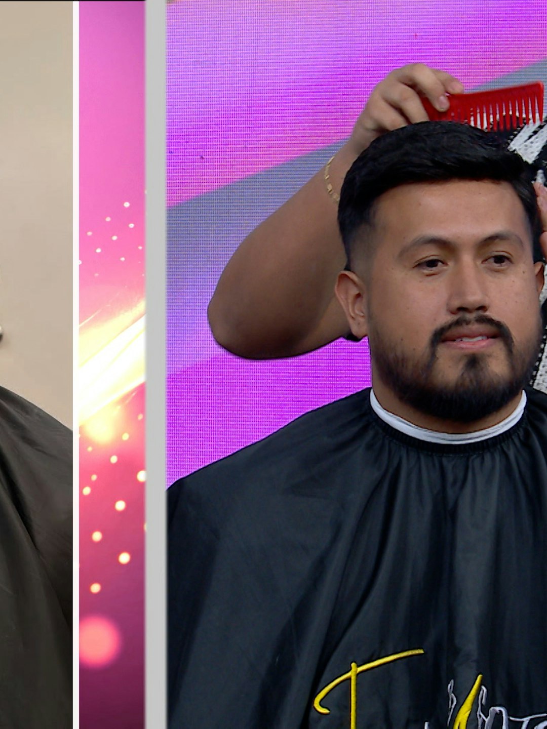 ¿Te estás quedando sin cabello? ¡Checa estas prótesis capilares prácticamente indetectables!