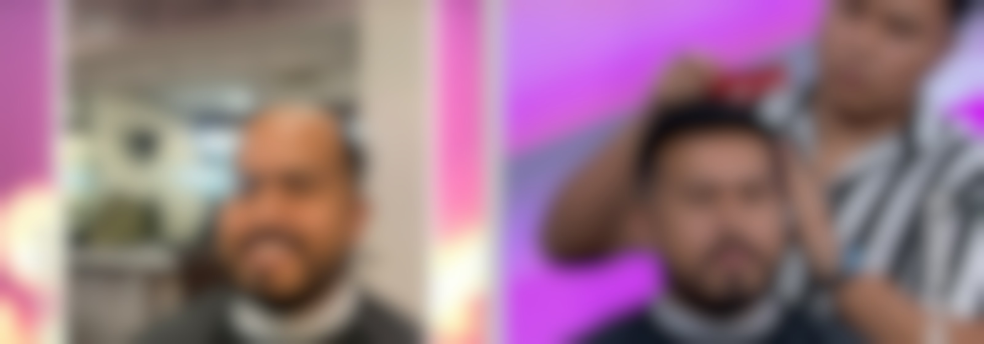 ¿Te estás quedando sin cabello? ¡Checa estas prótesis capilares prácticamente indetectables!
