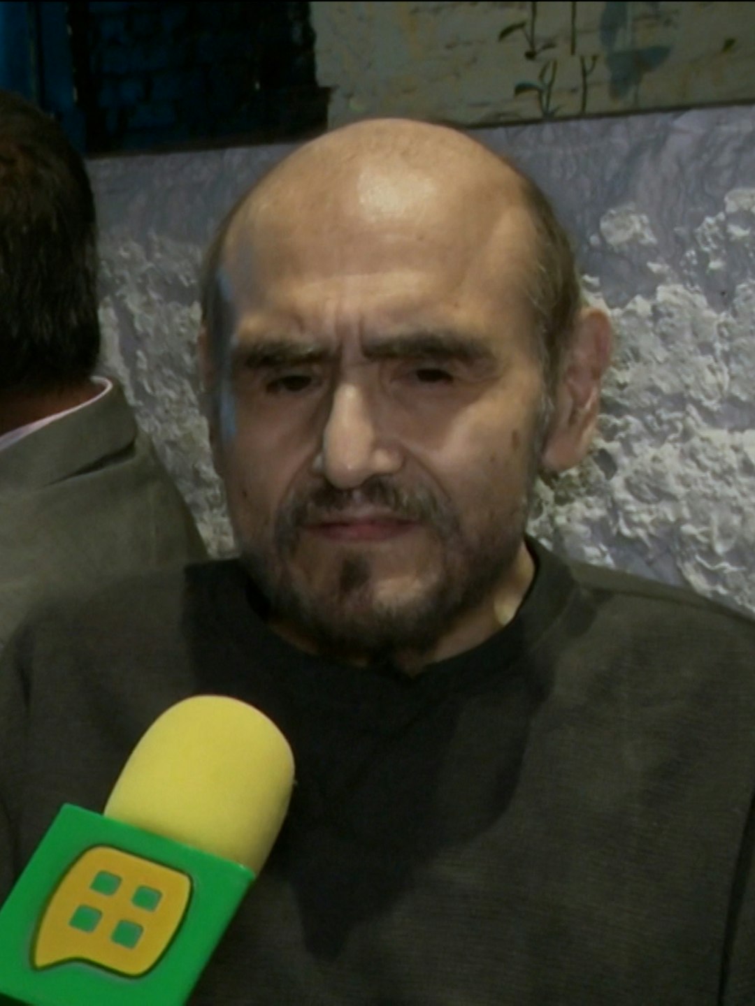 Exclusiva: Édgar Vivar se someterá a una cirugía de columna; “está sumamente desviada”