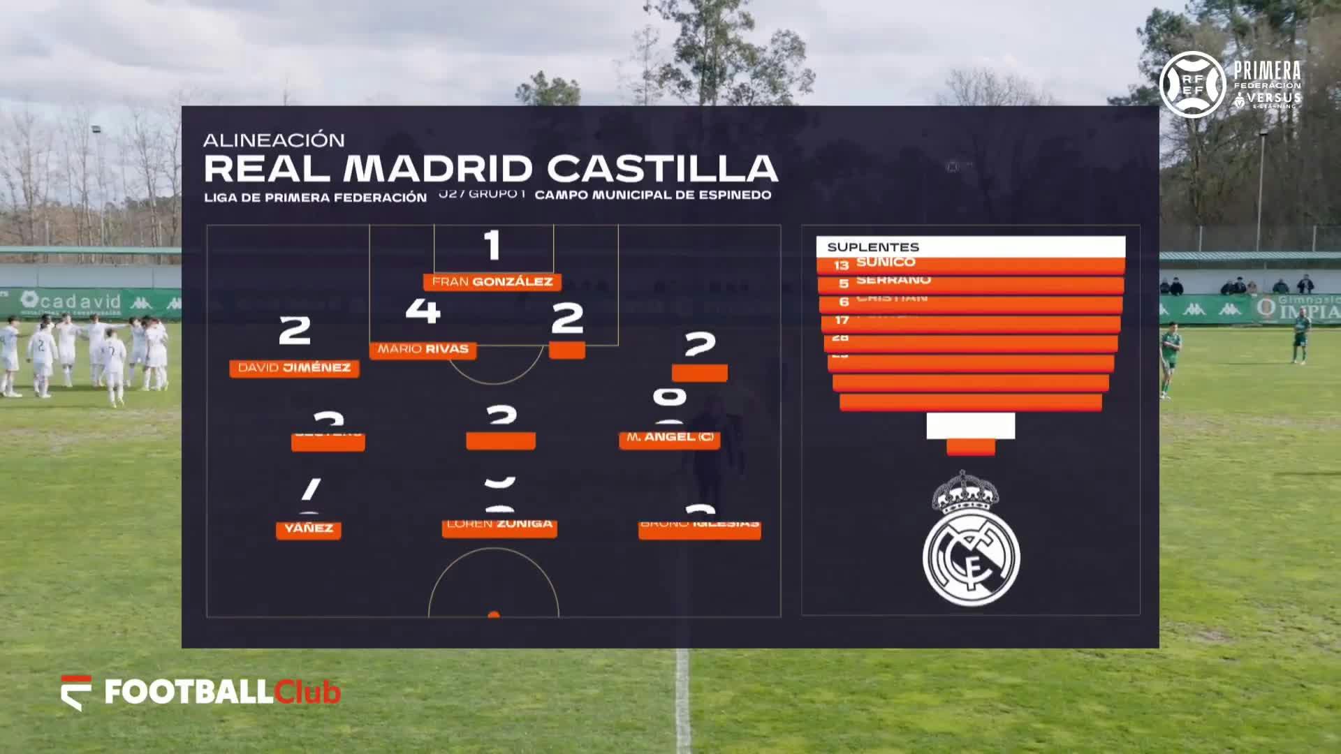 CD Arenteiro vs Real Madrid Castilla
