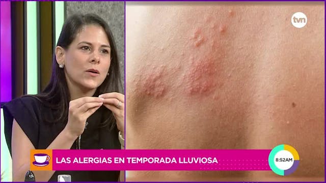 Cita Médica: Alergias en temporada lluviosa