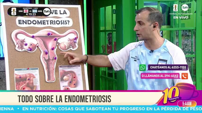 Cita Médica: Todo sobre la endometriosis 
